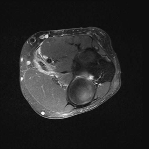 Click on the Serie image to view the images of Wieszt, Gnter